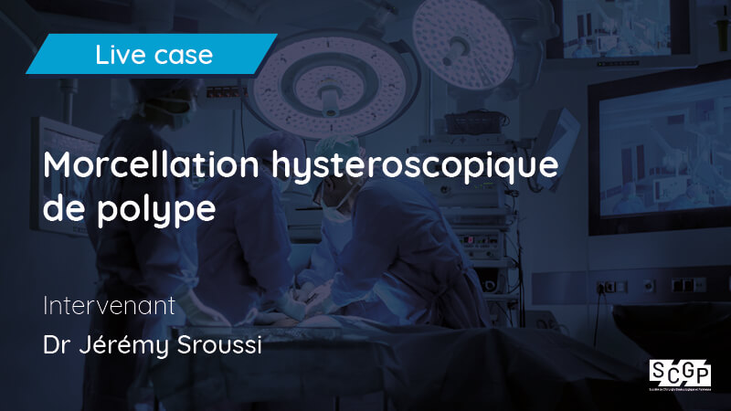 Morcellation hysteroscopique de polype