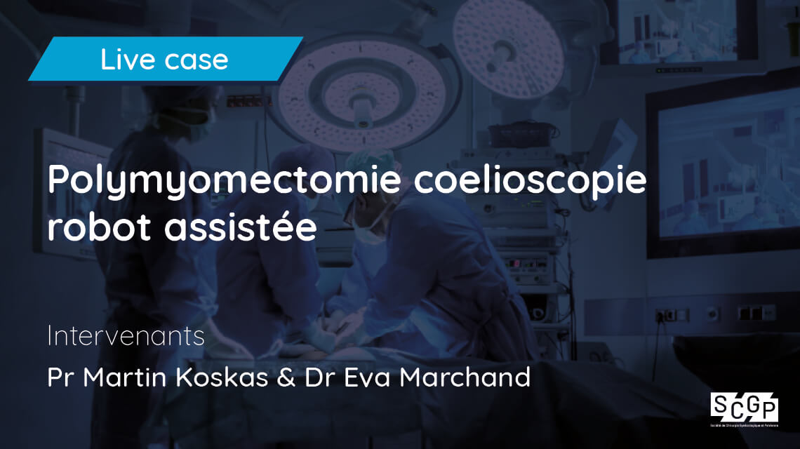 Polymyomectomie coelioscopie robot assistée