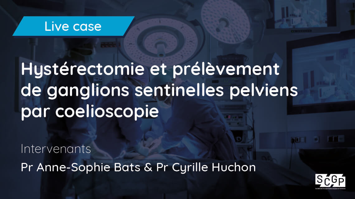 Hystérectomie et prélèvement de ganglions sentinelles pelviens par coelioscopie