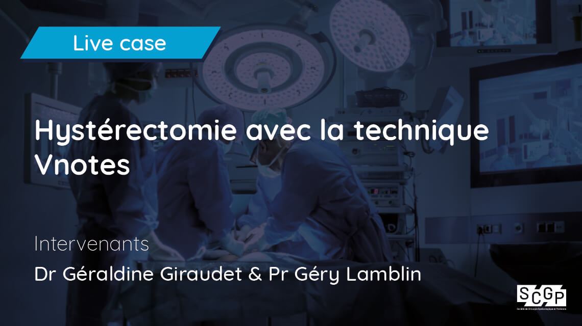 Hystérectomie avec la technique Vnotes